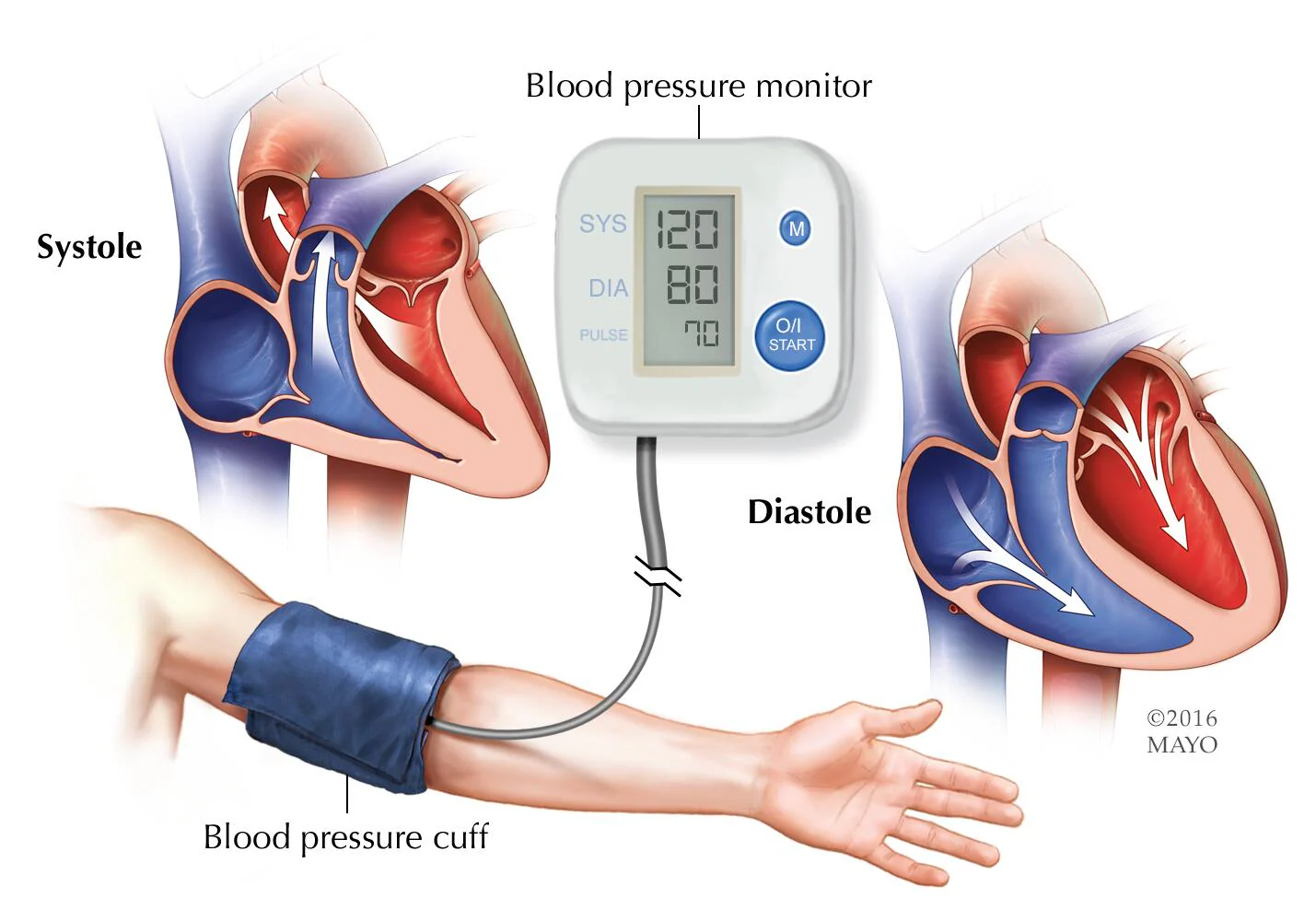 Best Blood Pressure Management in Firozabad